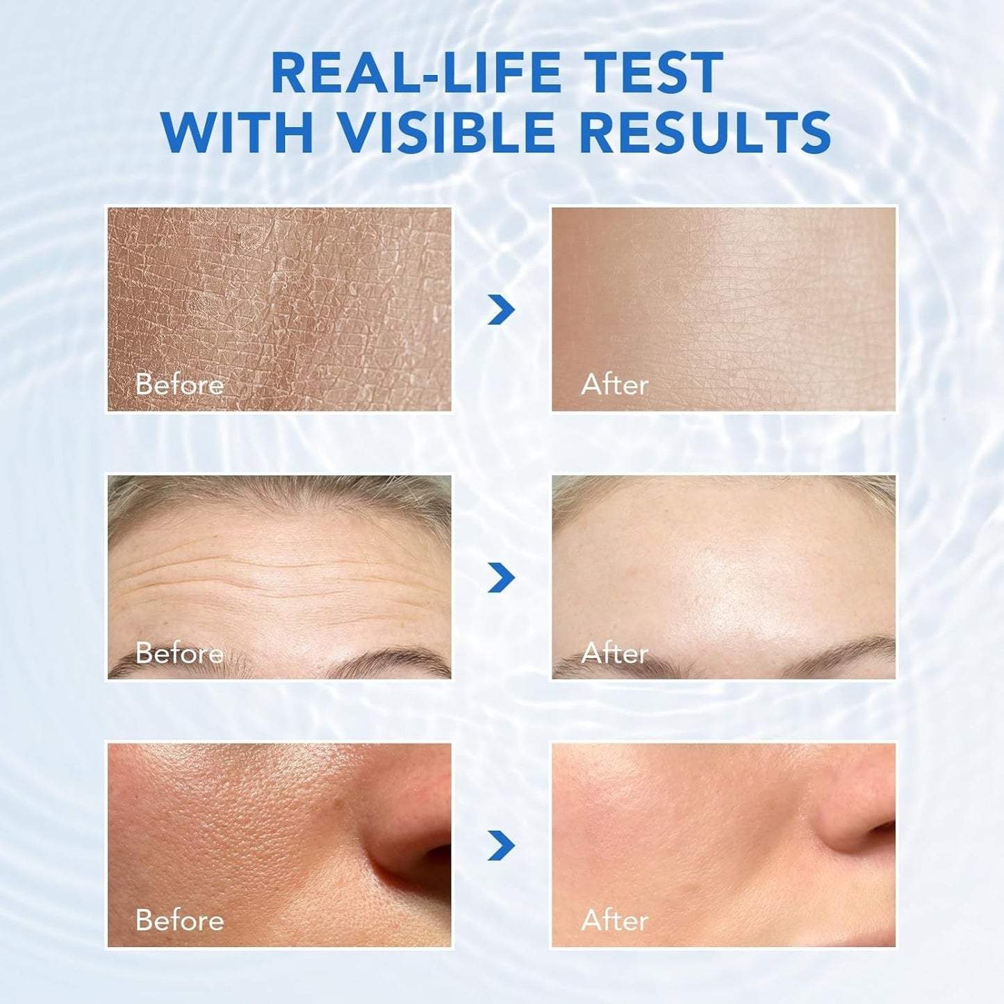 Acido Hialuronico Puro De Alta Potencia Reduce Manchas Arrugas De La Cara Y Piel