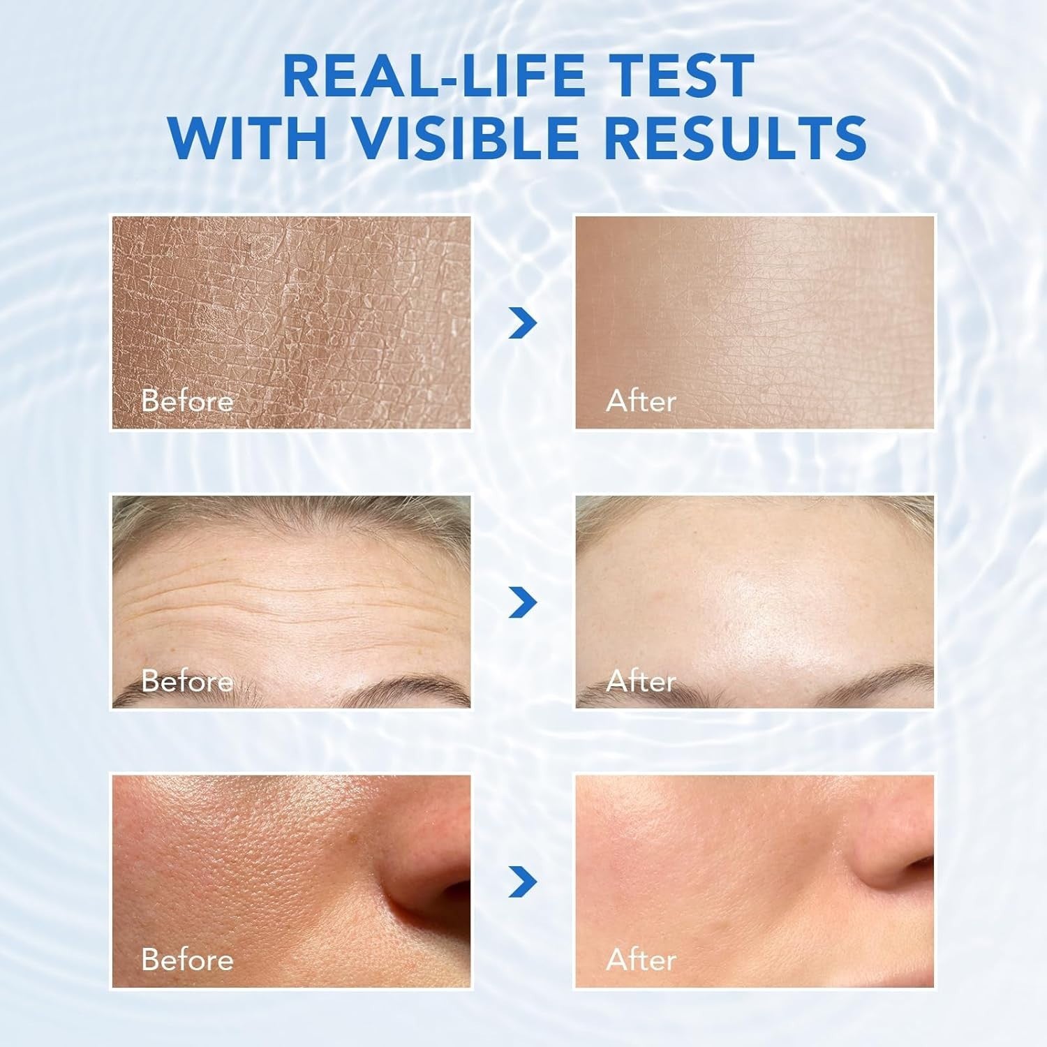 Acido Hialuronico Puro De Alta Potencia Reduce Manchas Arrugas De La Cara Y Piel
